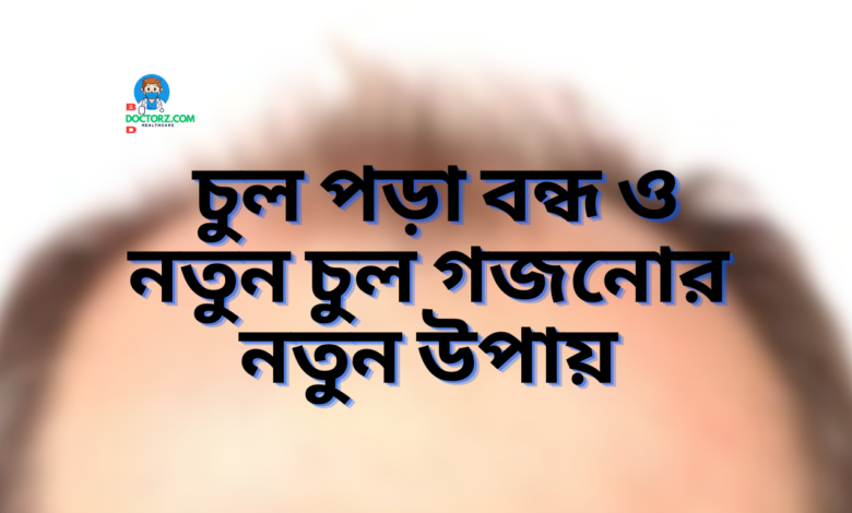 ৭ দিনে ছেলেদের চুল পড়া বন্ধ ও নতুন চুল গজনোর নতুন উপায়